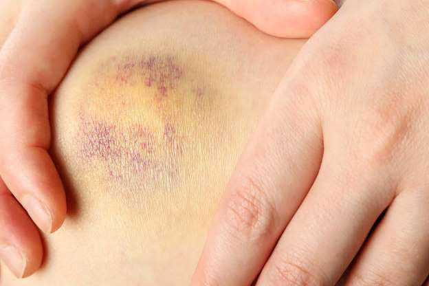13 dấu hiệu ung thư nam giới kh&ocirc;ng được bỏ qua