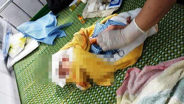 Bé trai còn nguyên dây rốn bị bỏ trong túi nylon treo trên xe máy