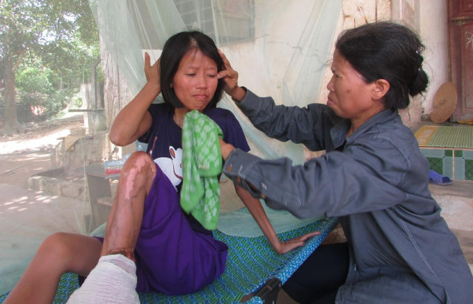 Hiện tại mọi sinh hoạt thường ngày của Thanh đều nhờ vào sự chăm sóc của người mẹ già.