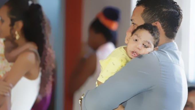 Virus Zika gây ra tật đầu nhỏ ở trẻ sơ sinh.