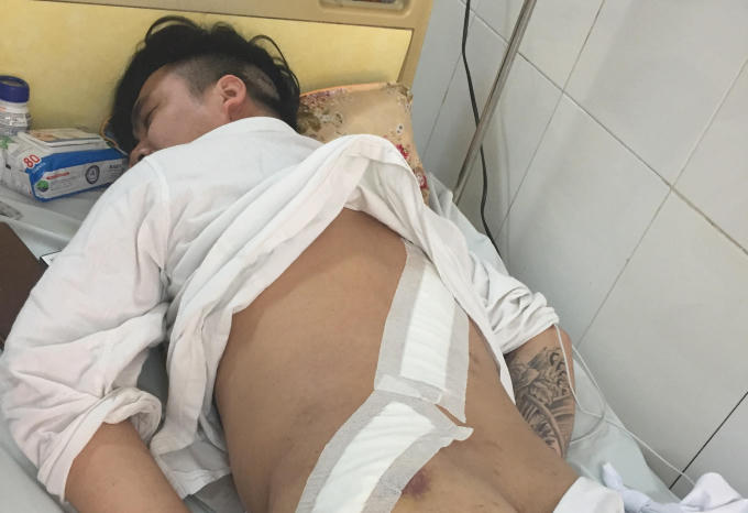 Anh Tuấn bị nhóm đối tượng chém vào lưng,đầu, vai phải nhập viện trong tình trạng đa chấn thương.