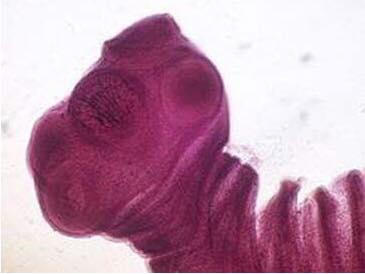 Đầu sán dải heo (sán dây lợn).