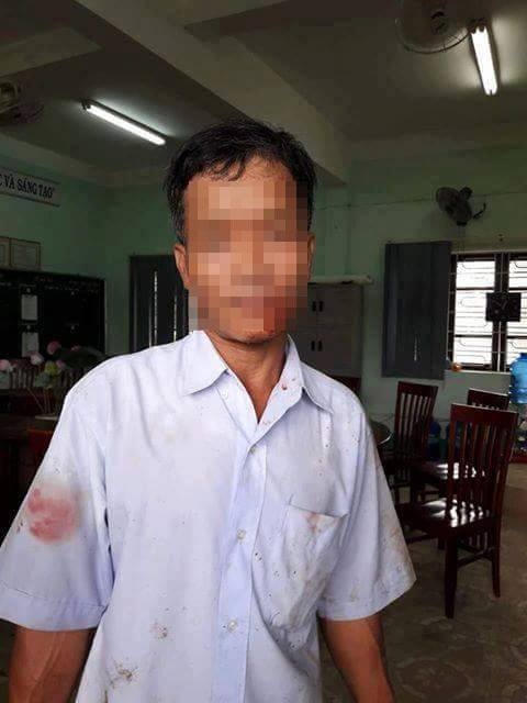 Ông H. với những thương tích trên người.