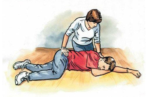 Cách sơ cứu người đột quỵ: đặt bệnh nhân nằm đầu thấp, mặt nghiêng sang một bên,...
