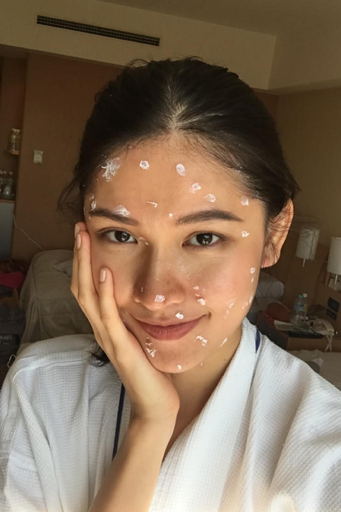 Thùy Dung bị thủy đậu trước thềm chung kết Hoa hậu Quốc tế.