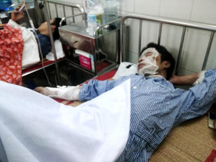 Bệnh nhân vụ nổ lò luyện thép đang điều trị tại bệnh viện Việt Tiệp.