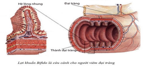Bảo vệ đại tràng cho người hay uống rượu bia theo cách của người Nhật