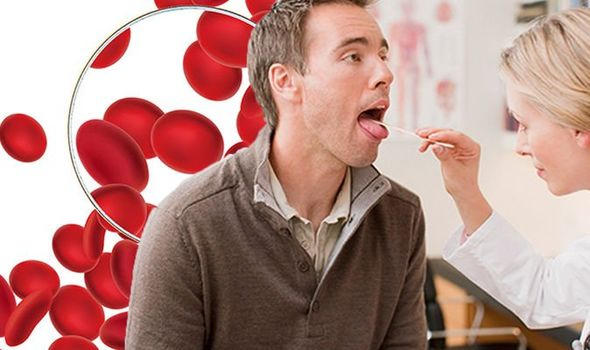 Dấu hiệu cho biết bạn đang thiếu vitamin B12 và thiếu máu