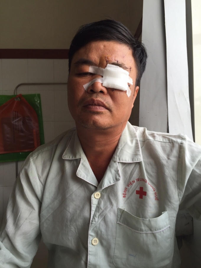 Ông Hoàng Đắc Phường đang điều trị tại bệnh viện Trung ương Huế.