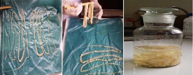 108 người ở Bình Phước nhiễm ấu trùng sán lợn gạo.