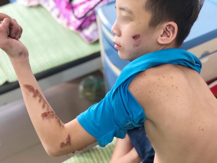 Hình ảnh đầy thương tích của Duy