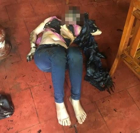 Nạn nhân bị chồng cũ đốt vì từ chối níu kéo tình cảm.
