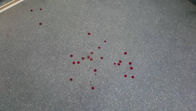 Máu của nạn nhân chảy rơi vãi dưới đất. Ảnh: H.A / An ninh thủ đô.