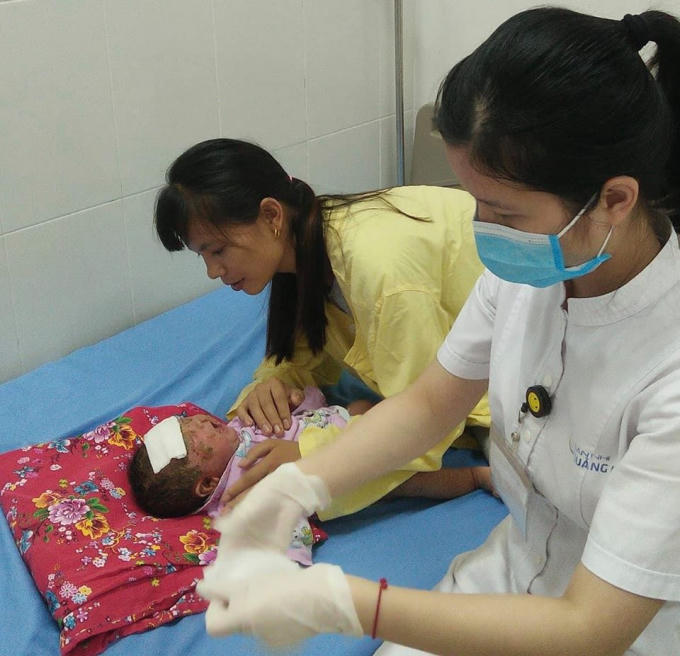 Bé T. được điều trị tại bệnh viện. Ảnh: BVCC