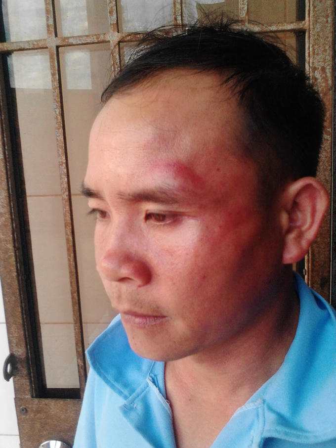 Nhiều kẻ lạ mặt đã dùng mũ bảo hiểm đánh mạnh vào mặt ông Tiến.