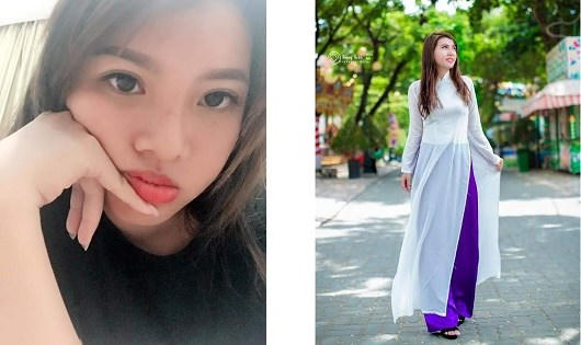 Mẹ đơn thân Quách Thị Kim Phượng (22 tuổi, Đắk Nông) sau phẫu thuật.