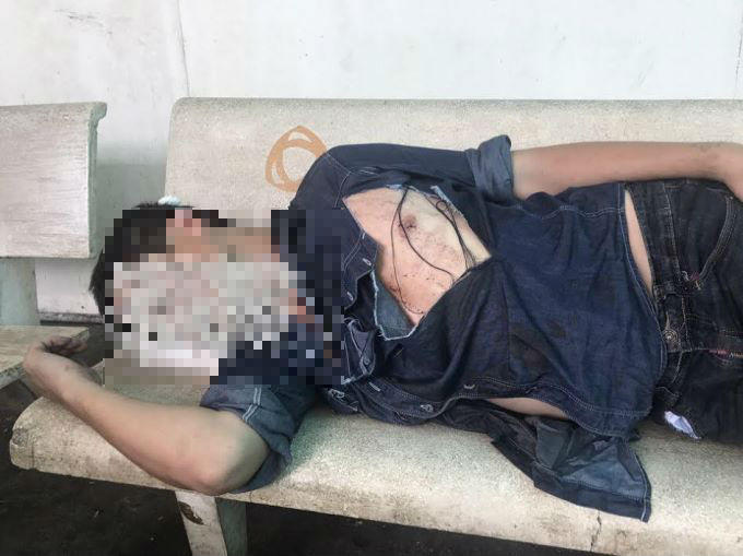 Anh T. lúc bị nhóm đối tượng đánh trọng thương.