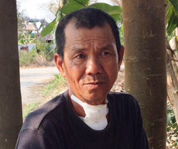 Nạn nhân bị thương nặng ở cổ.