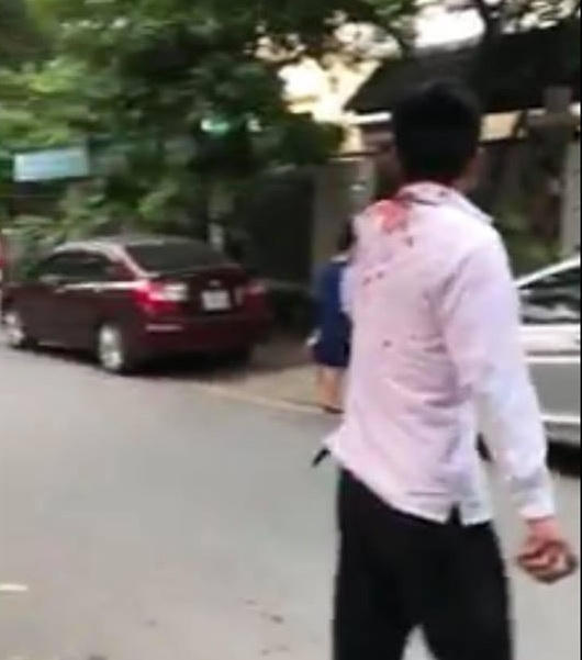 Tài xế lái xa Taxi bị đánh chảy máu đầu và phải nhập viện cấp cứu. Ảnh cắt từ clip.