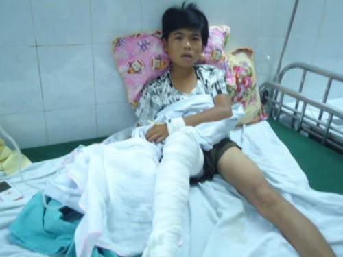 Em Chiến đang được điều trị tại Viện Bỏng quốc gia tại Hà Nội. (Ảnh: Vietnamnet)