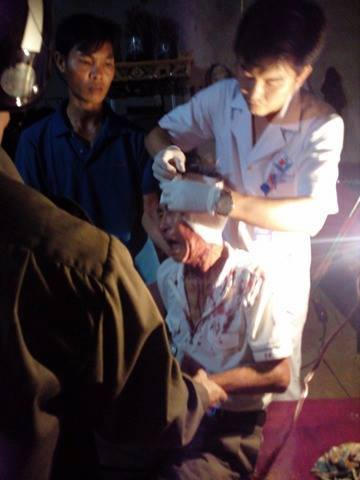 Ông Quân bị đối tượng dùng đá ném gây chấn thương, chảy máu đầu.