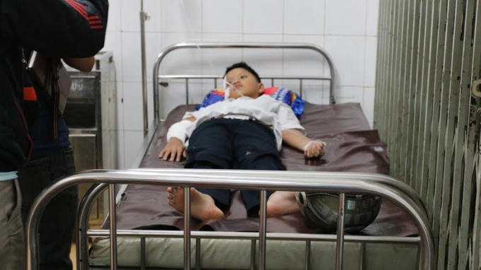 5 trường hợp thì có một em bị bỏng nặng trên 11%.