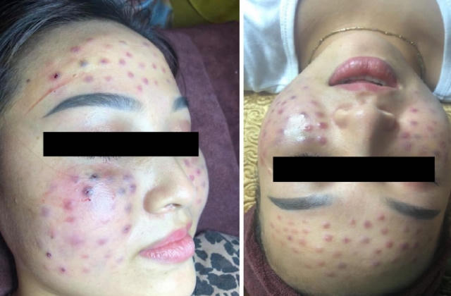 Vụ spa