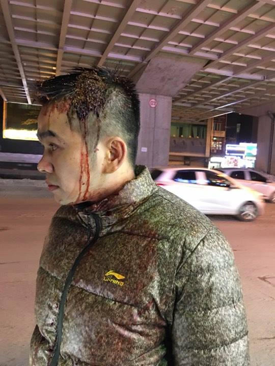 Anh Nguyễn Kim Đính bị thương ở vùng đầu.