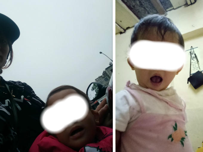 Cháu Lê Thị Thùy T. (hơn 1 tuổi) bị thâm ở 2 mắt và 1 số vết thương khác trên cơ thể sau khi rời Cơ sở mầm non Tràng An về nhà.