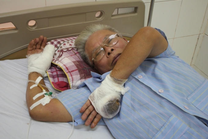 Ông Lộc khẳng định mình không hề quen biết hai đối tượng lạ mặt đã vung dao chém mình.