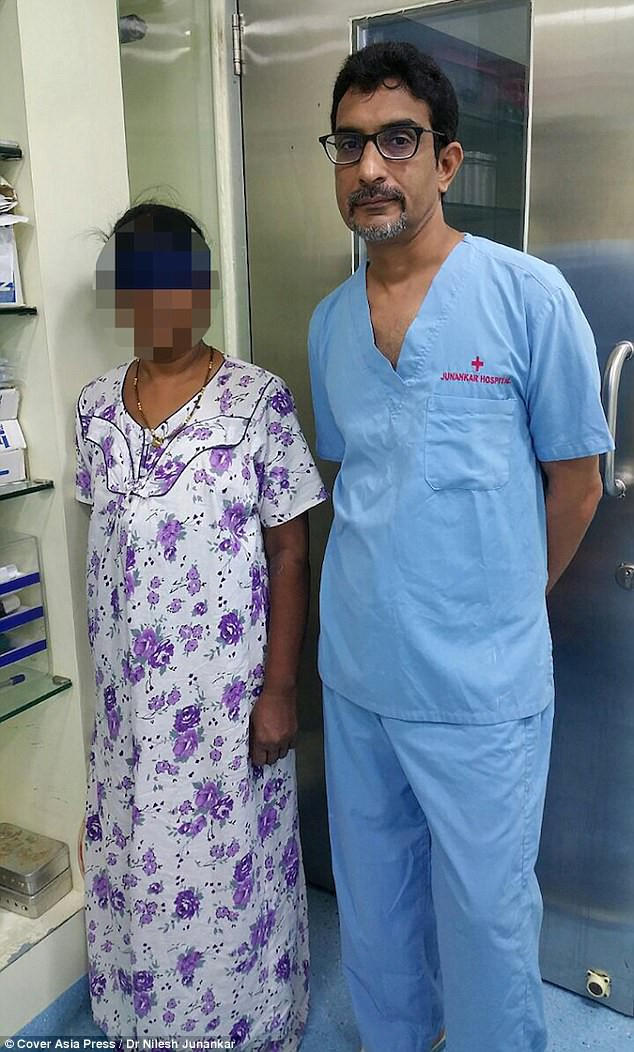 Sốc: Ph&aacute;t hiện b&agrave;o thai trong bụng sau 15 năm bỏ thai