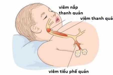 Trẻ dưới 2 tuổi dễ mắc viêm tiểu phế quản khi trời lạnh. Ảnh: Giáo dục Thời đại