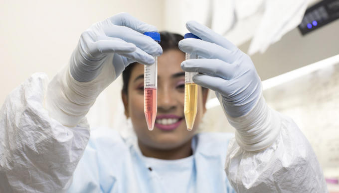 X&eacute;t nghiệm mới gi&uacute;p ph&aacute;t hiện HIV ẩn