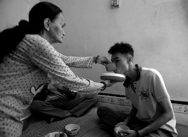 Đã 25 tuổi, nhưng Long không khác gì đứa trẻ. Mọi việc bà Bé đều phải phụ giúp Long.