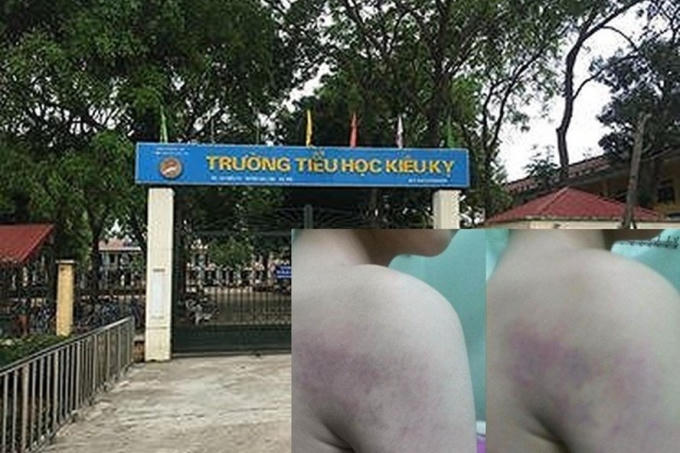 Trường Tiểu học Kiêu Kỵ, nơi xảy ra sự việc cô giáo dùng thước đánh học sinh vì chậm hiểu bài (Ảnh: Lao động)