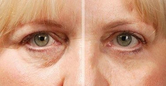 11 thủ thuật “hô biến” làm da mặt toả sáng