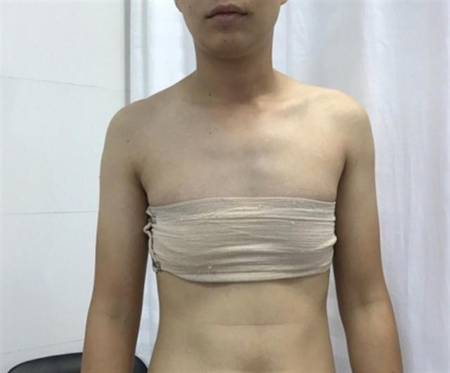Bộ Y tế đề xuất 3 giải pháp về chuyển giới. Ảnh minh họa