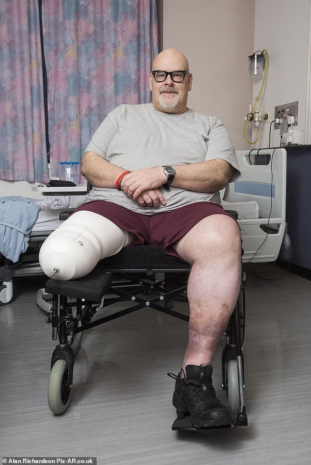 Ông Rattray bỏ qua lời khuyên của bác sĩ dẫn đến việc phải cắt chân