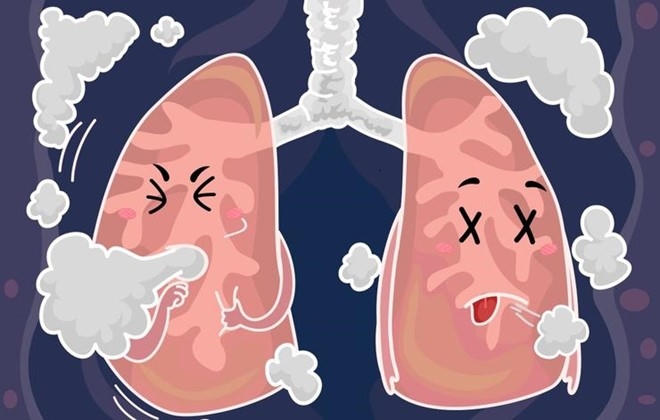 8 dấu hiệu cảnh b&aacute;o phổi c&oacute; vấn đề