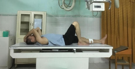 Đàm Vĩnh Hưng cấp cứu trong đêm, khâu 6 mũi