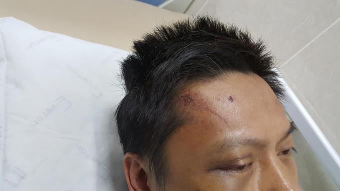 Nạn nh&acirc;n bị bảo vệ Bệnh viện Phụ sản H&agrave; Nội h&agrave;nh hung l&ecirc;n tiếng