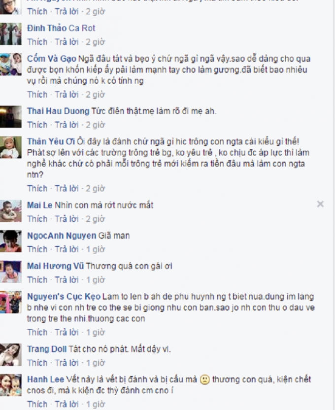 Hầu hết cư dân mạng đều nghi vấn những vết thương trên người bé không phải do ngã. (Nguồn: FB).