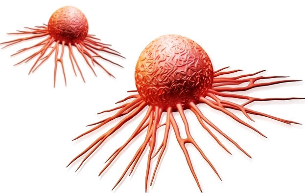 Tế b&agrave;o ung thư ph&aacute;t triển v&agrave; ph&acirc;n chia nhanh ch&oacute;ng, c&oacute; khả năng x&acirc;m lấn, l&acirc;y lan sang c&aacute;c cơ quan kh&aacute;c. Ảnh: minh họa/D&acirc;n Tr&iacute;