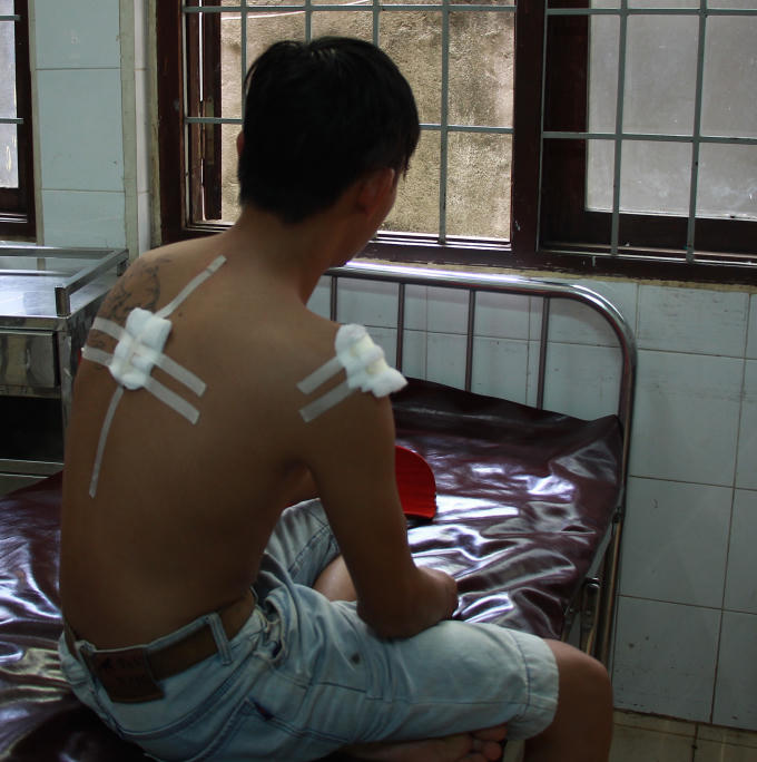 Một trong 3 bệnh nhân vi phạm giao thông bị thương do Công an xã bắn.