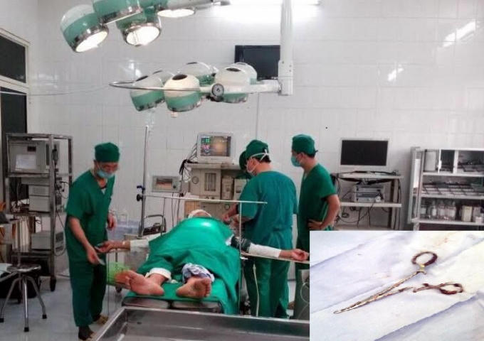 Ca phẫu thuật kéo dài đã lấy thành công chiếc panh để quên suốt hơn 18 năm qua trong ổ bụng.