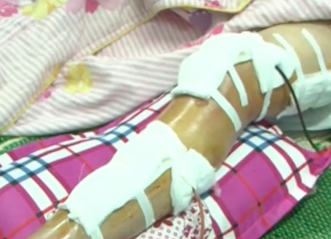 Vết thương của Trung úy Hoàng Duy Thành quá nặng phải đi bệnh viện cấp cứu tại bệnh viên.