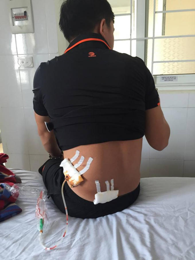 Nạn nhân Nguyễn Xuân T hiện đang điều trị tại BV Đa khoa tỉnh Hà Tĩnh.
