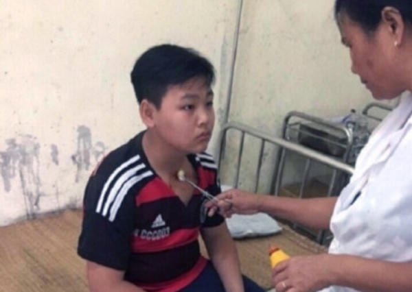 Hoc sinh Tuấn tại trạm y tế xã sau khi bị thầy giáo đánh