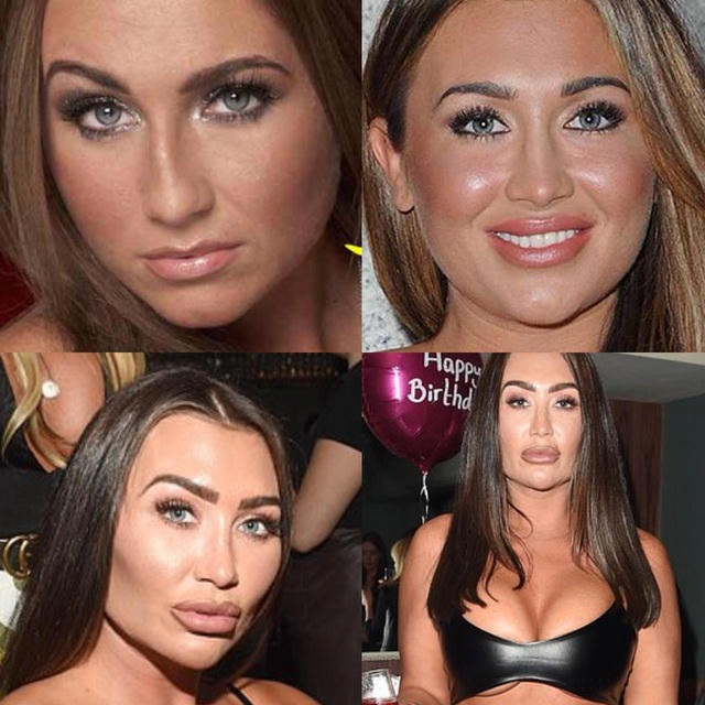 Gương mặt của Lauren Goodger quá khác lạ trong vài năm trở lại đây