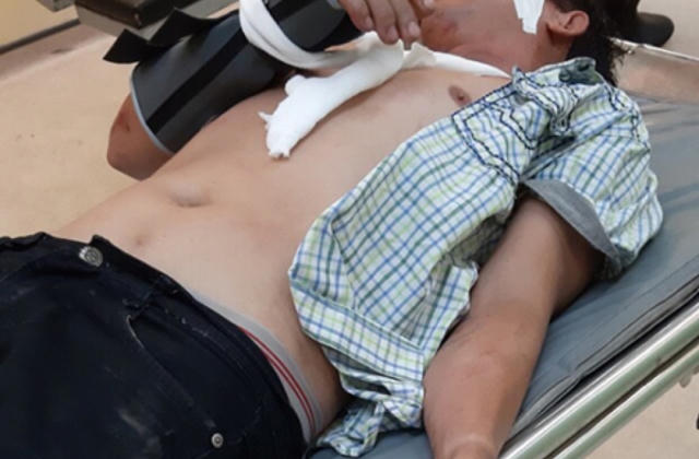 Gây tai nạn giao thông, đến công an trình báo bị đánh trọng thương trong đêm